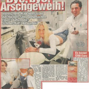 Pressebericht Tattoo Entfernung