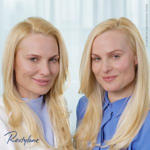 Faltenbehandlung Praxis Dr. Kai Rezai Münster