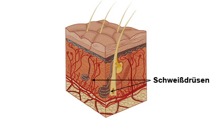 Schweißdrüsenabsaugung