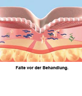 Sculptra Praxis Dr. Kai Rezai Münster