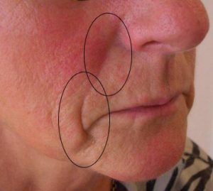 Sculptra Praxis Dr. Kai Rezai Münster