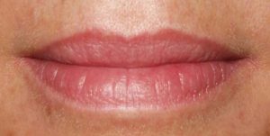 Permanent Make Up Entfernung