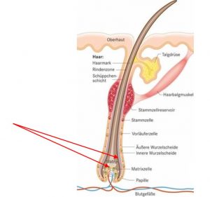 Laser Haarentfernung Laser Haarentfernung