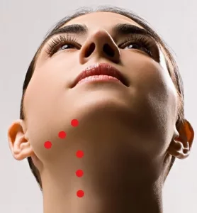 Nofretete-Lift Dr. Kai Rezai